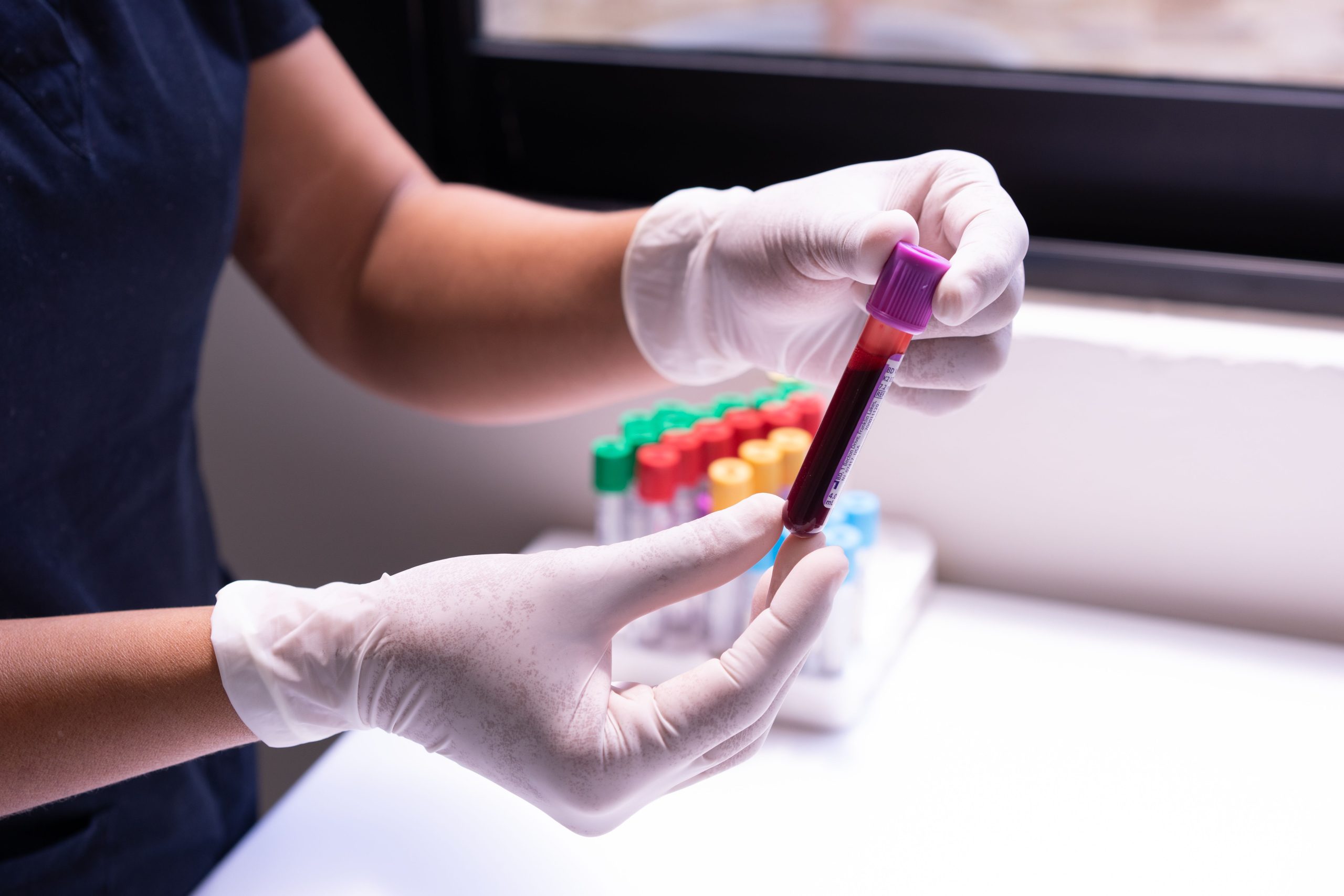 Lab Work